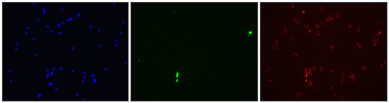 3 channel epifluoresence image